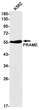 Western blot detection of PRAME in K562 cell lysates using PRAME Rabbit mAb(1:1000 diluted).Predicted band size:58kDa.Observed band size:58kDa.