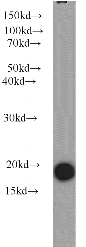 Jurkat cells were subjected to SDS PAGE followed by western blot with Catalog No:115698(STMN1 antibody) at dilution of 1:800