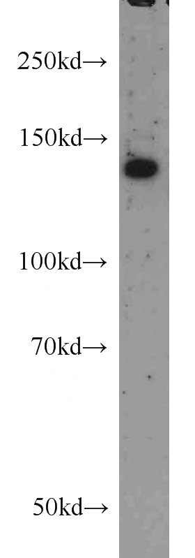 human brain tissue were subjected to SDS PAGE followed by western blot with Catalog No:114477(RASGRF1 antibody) at dilution of 1:600