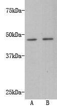 Fig1: Western blot analysis of Transmembrane protein 200A on A549 (1) and HepG2 (2) using anti-Transmembrane protein 200A antibody at 1/500 dilution.