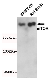 Western blot analysis of mTOR expression in SHSY-5Y and Rat Brain cell lysates using mTOR antibody at 1/1000 dilution.Predicted band size:289KDa.Observed band size:289KDa.