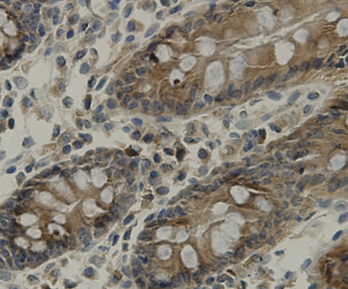 Fig5: Immunohistochemical analysis of paraffin-embedded human colon tissue using anti-TMEM177 antibody. Counter stained with hematoxylin.