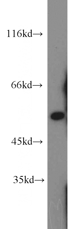 mouse liver tissue were subjected to SDS PAGE followed by western blot with Catalog No:107974(ALDH7A1 antibody) at dilution of 1:1000