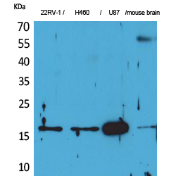 Fig1:; Western Blot analysis of 22RV-1, H460, U87, mouse brain cells using Apelin Polyclonal Antibody.. Secondary antibody（catalog#: HA1001) was diluted at 1:20000