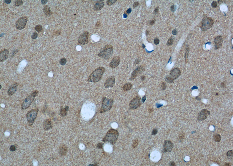 Immunohistochemistry of paraffin-embedded rat brain tissue slide using Catalog No:107550(14-3-3 Antibody) at dilution of 1:50 (under 40x lens)