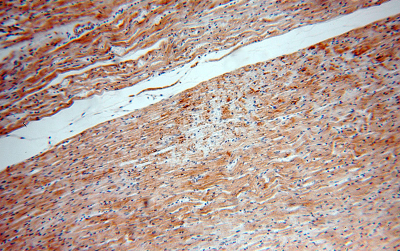 Immunohistochemical of paraffin-embedded human heart using Catalog No:116996(XPR1 antibody) at dilution of 1:100 (under 10x lens)