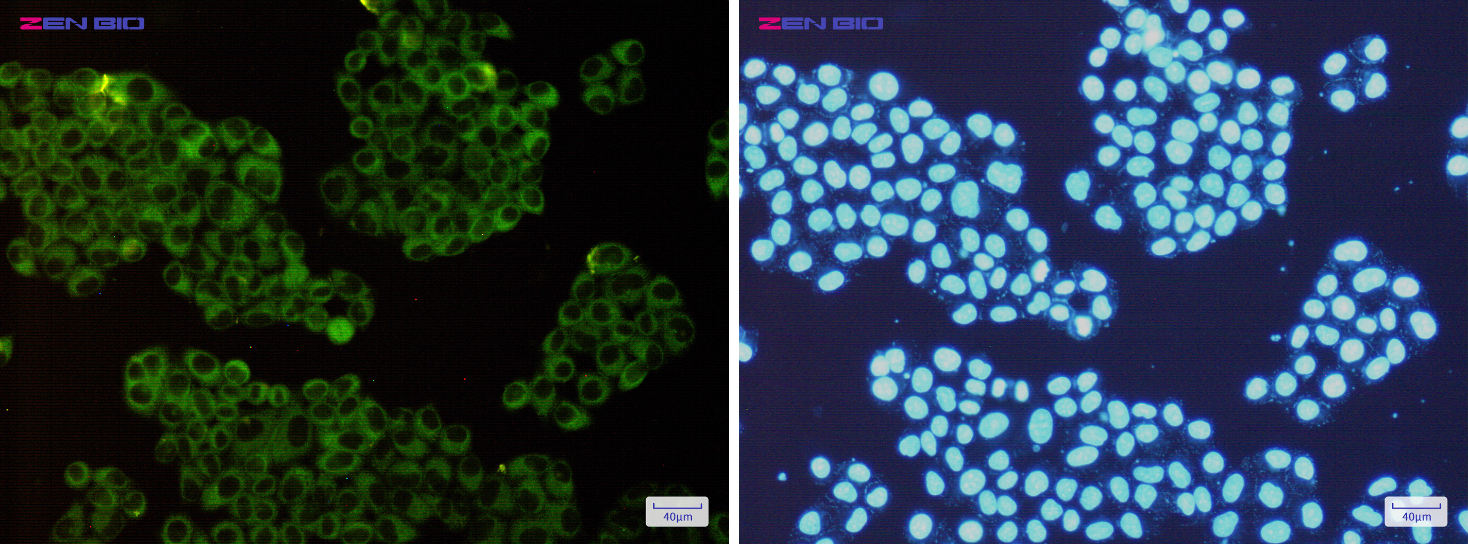 Immunocytochemistry of ROCK2(green) in Hela cells using ROCK2 Rabbit mAb at dilution 1/200, and DAPI(blue)