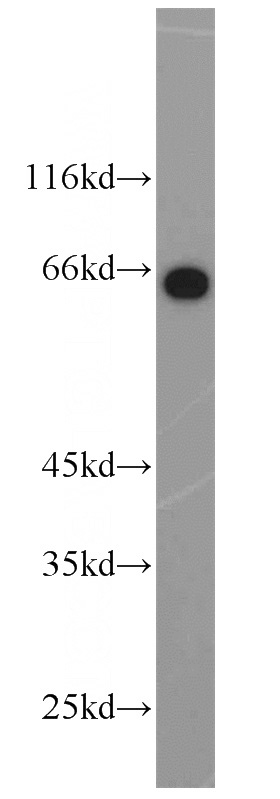 HeLa cells were subjected to SDS PAGE followed by western blot with Catalog No:111560(HSF4 antibody) at dilution of 1:1000