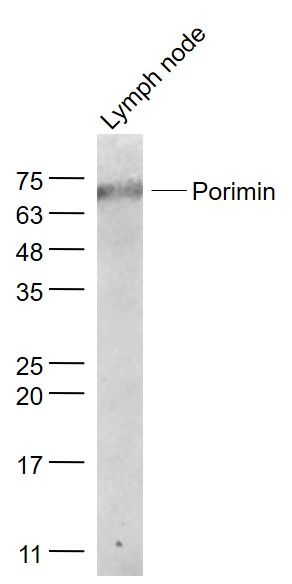 Fig2: Sample:; Lymph node (Mouse) Lysate at 40 ug; Primary: Anti- Porimin at 1/1000 dilution; Secondary: IRDye800CW Goat Anti-Rabbit IgG at 1/20000 dilution; Predicted band size: 19 kD; Observed band size: 74 kD
