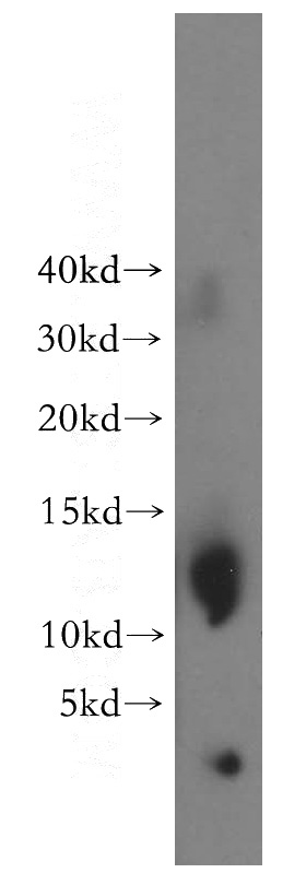 human adrenal gland tissue were subjected to SDS PAGE followed by western blot with Catalog No:115140(SF3B5 antibody) at dilution of 1:400