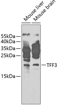 Western blot - TFF3 Polyclonal Antibody 