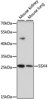 Western blot - SSX4 Polyclonal Antibody 