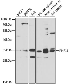 Western blot - PHF11 Polyclonal Antibody 