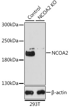 Western blot - NCOA2 Polyclonal Antibody 