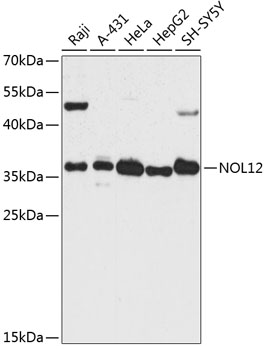 Western blot - NOL12 Polyclonal Antibody 