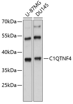 Western blot - C1QTNF4 Polyclonal Antibody 