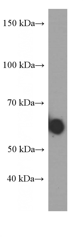 human saliva tissue were subjected to SDS PAGE followed by western blot with Catalog No:107270(Human IgA Antibody) at dilution of 1:16000