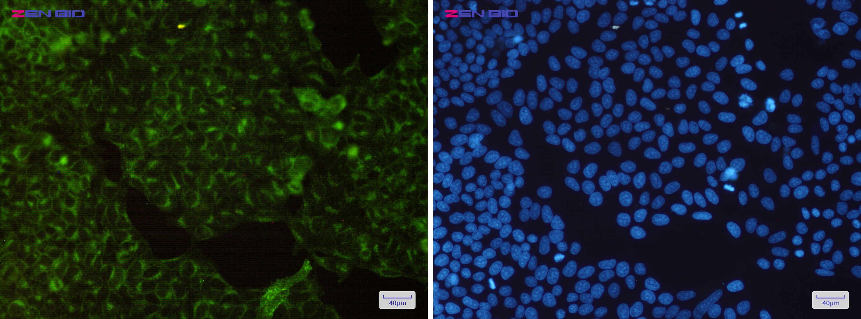 Immunocytochemistry of Transferrin Receptor(green) in Hela cells using Transferrin Receptor Rabbit mAb at dilution 1/200, and DAPI(blue)