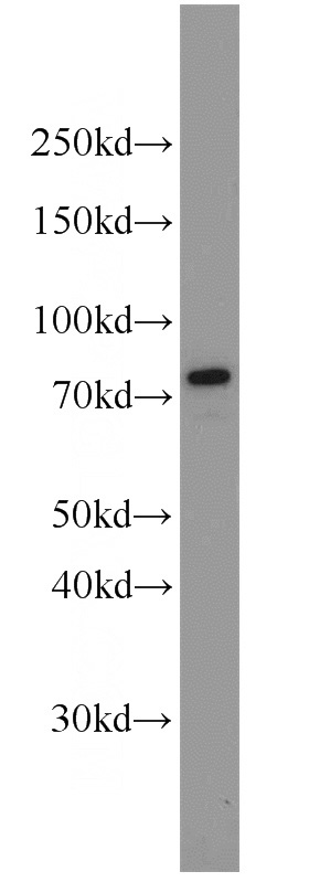 HepG2 cells were subjected to SDS PAGE followed by western blot with Catalog No:111221(GRP78,BIP antibody) at dilution of 1:1000