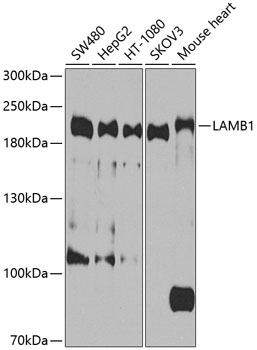 Western blot - LAMB1 Polyclonal Antibody 