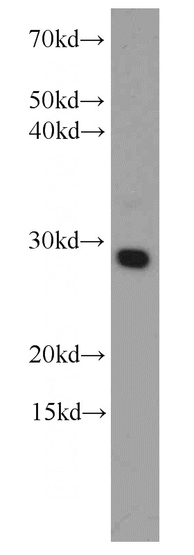 HEK-293 cells were subjected to SDS PAGE followed by western blot with Catalog No:107504(EBAG9 Antibody) at dilution of 1:1000