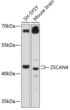 Western blot - ZSCAN4 Polyclonal Antibody 