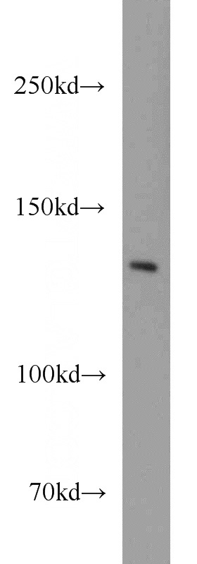 Jurkat cells were subjected to SDS PAGE followed by western blot with Catalog No:116210(TPP2 antibody) at dilution of 1:1000