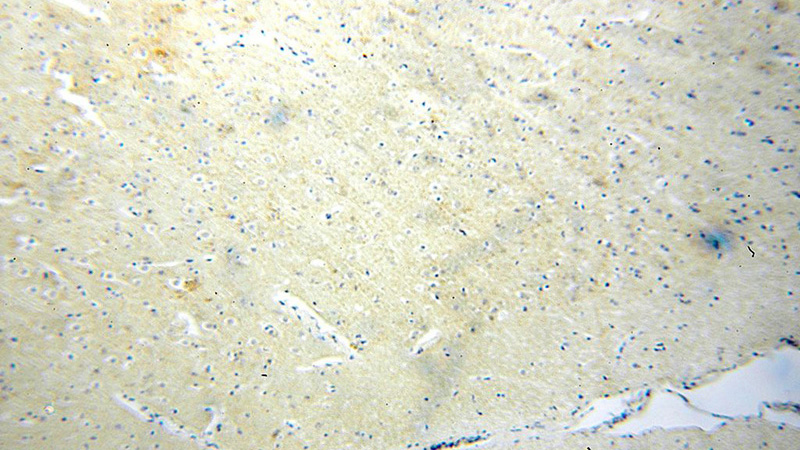 Immunohistochemical of paraffin-embedded human brain using Catalog No:114699(RIC8B antibody) at dilution of 1:100 (under 10x lens)