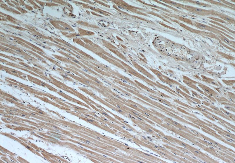 Immunohistochemical of paraffin-embedded human heart using Catalog No:107311(HADHA antibody) at dilution of 1:50 (under 10x lens)