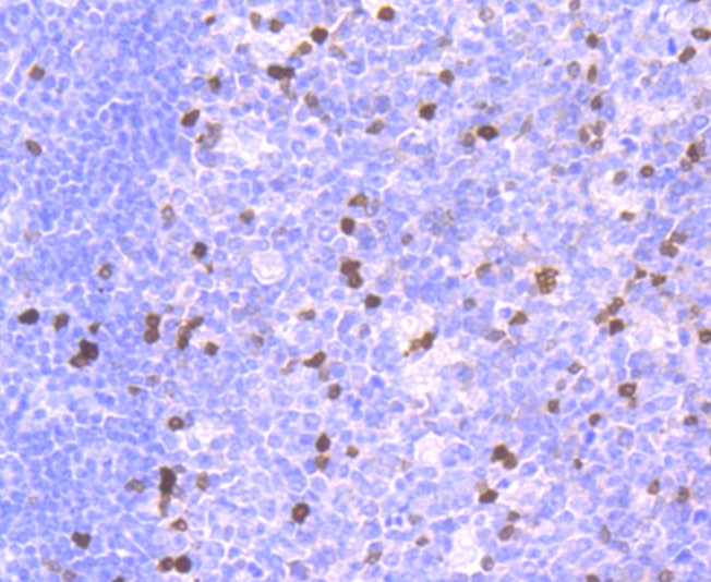 Fig1:; Immunohistochemical analysis of paraffin-embedded human tonsil tissue using anti-Parvalbumin antibody. The section was pre-treated using heat mediated antigen retrieval with Tris-EDTA buffer (pH 9.0) for 20 minutes.The tissues were blocked in 1% BSA for 30 minutes at room temperature, washed with ddH; 2; O and PBS, and then probed with the primary antibody ( 1/50) for 30 minutes at room temperature. The detection was performed using an HRP conjugated compact polymer system. DAB was used as the chromogen. Tissues were counterstained with hematoxylin and mounted with DPX.