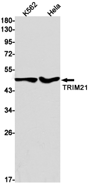 Western blot detection of TRIM21 in K562,Hela cell lysates using TRIM21 Rabbit mAb(1:1000 diluted).Predicted band size:54kDa.Observed band size:50kDa.
