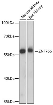 Western blot - ZNF766 Polyclonal Antibody 