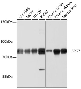Western blot - SPG7 Polyclonal Antibody 
