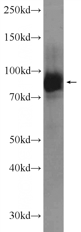 Jurkat cells were subjected to SDS PAGE followed by western blot with Catalog No:112341(LRSAM1 Antibody) at dilution of 1:1000