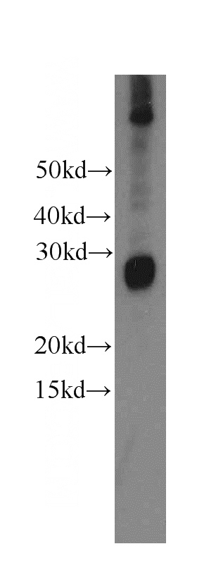 HeLa cells were subjected to SDS PAGE followed by western blot with Catalog No:113387(NSMCE2 antibody) at dilution of 1:500
