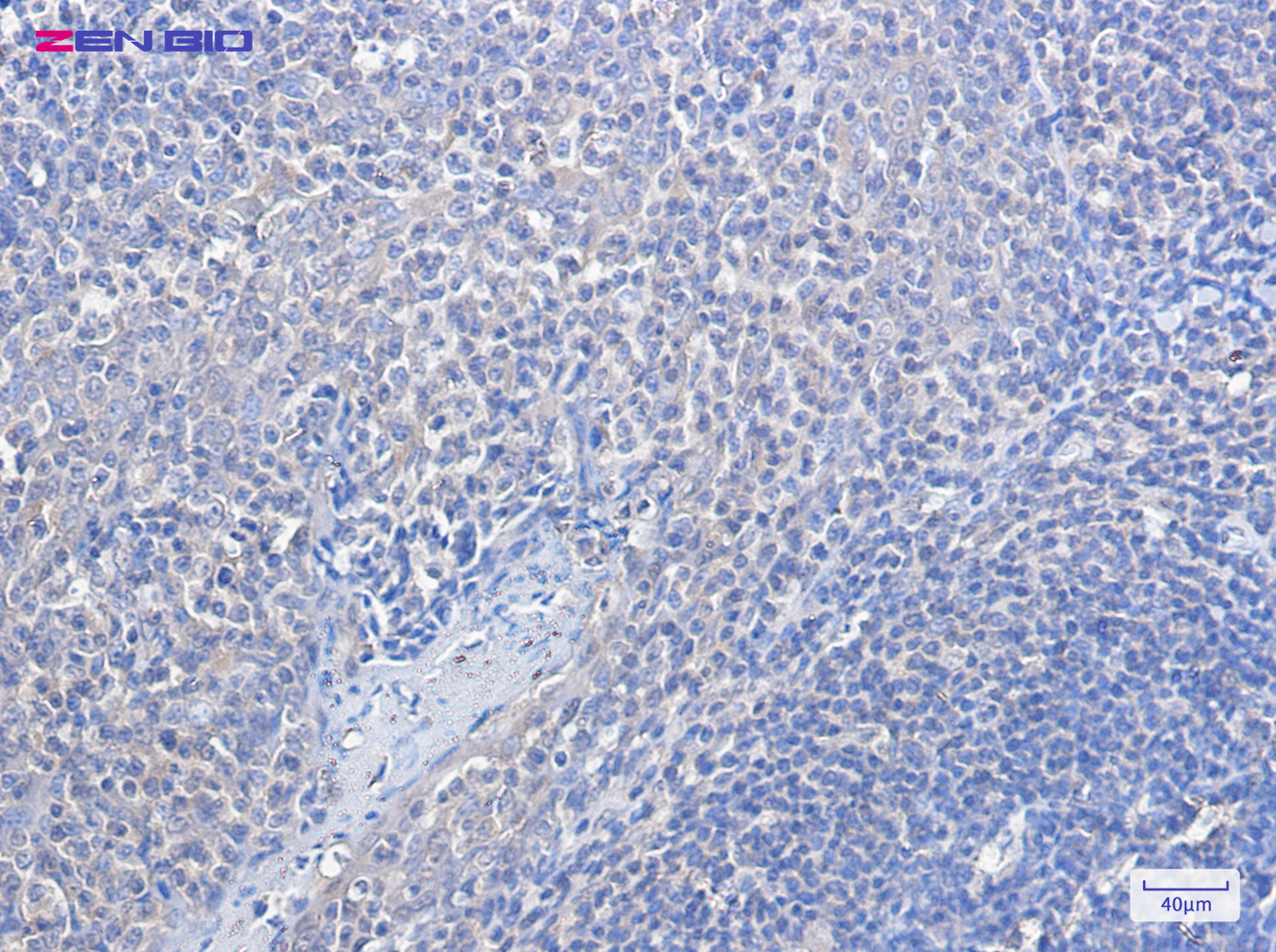 Immunohistochemistry of FOXO1A in paraffin-embedded Human tonsil using FOXO1A Rabbit pAb at dilution 1/100