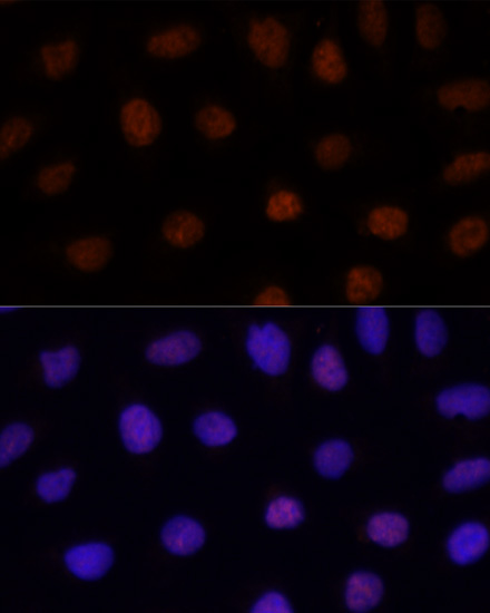Immunofluorescence - GLI2 Polyclonal Antibody 
