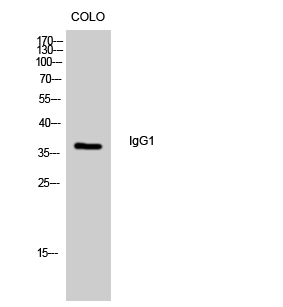 Fig1:; Western Blot analysis of colo cells using IgG1 Polyclonal Antibody diluted at 1: 500