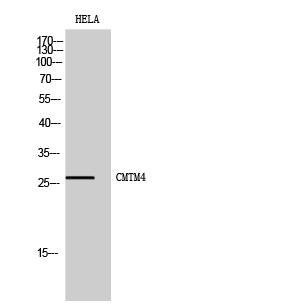 Fig1:; Western Blot analysis of HELA cells using CMTM4 Polyclonal Antibody