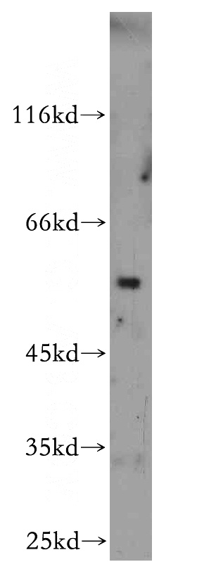 mouse brain tissue were subjected to SDS PAGE followed by western blot with Catalog No:114775(ROBO3-Specific antibody) at dilution of 1:300