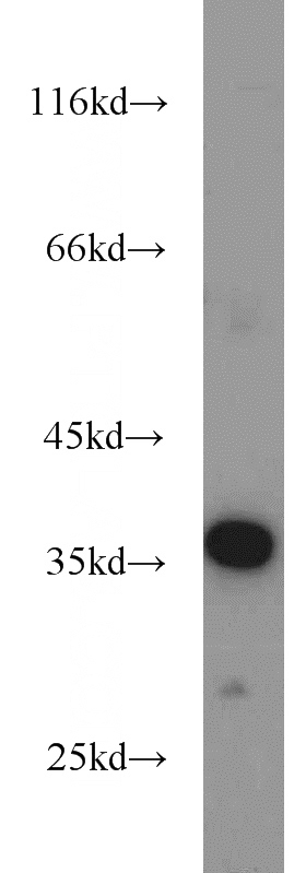 mouse liver tissue were subjected to SDS PAGE followed by western blot with Catalog No:111553(HSD3B7 antibody) at dilution of 1:500
