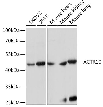 Western blot - ACTR10 Polyclonal Antibody 