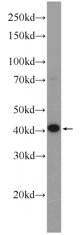 rat brain tissue were subjected to SDS PAGE followed by western blot with Catalog No:113020(NANOG Antibody) at dilution of 1:2000