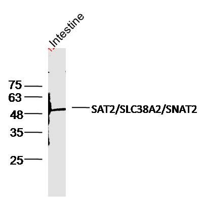 Fig2: Sample:; Intestine (Mouse) Lysate at 40 ug; Primary: Anti-SLC38A2 at 1/300 dilution; Secondary: IRDye800CW Goat Anti-Rabbit IgG at 1/20000 dilution; Predicted band size: 56 kD; Observed band size: 56 kD