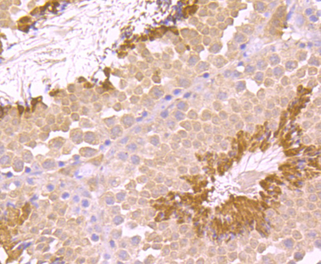 Fig6: Immunohistochemical analysis of paraffin-embedded mouse testis tissue using anti-TGM6 antibody. Counter stained with hematoxylin.