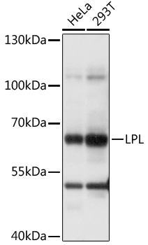 Western blot - LPL Polyclonal Antibody 