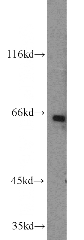 MCF7 cells were subjected to SDS PAGE followed by western blot with Catalog No:113408(NUCB1 antibody) at dilution of 1:1000