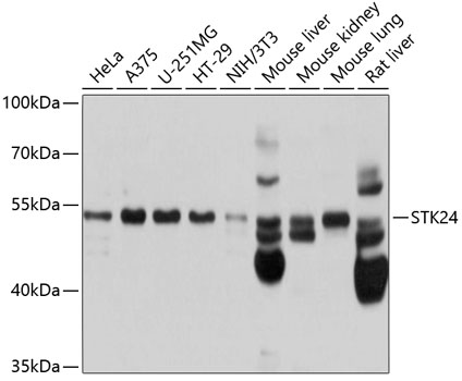 Western blot - STK24 Polyclonal Antibody 