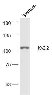 Fig1: Sample:; Stomach (Mouse) Lysate at 40 ug; Primary: Anti-Kv2.2 at 1/500 dilution; Secondary: IRDye800CW Goat Anti-Rabbit IgG at 1/20000 dilution; Predicted band size: 102 kD; Observed band size: 102 kD