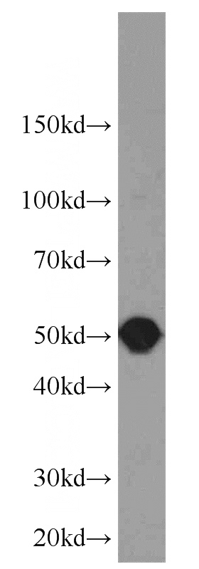 K-562 cells were subjected to SDS PAGE followed by western blot with Catalog No:115122(SEPT8 antibody) at dilution of 1:1000